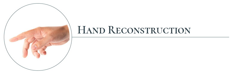 services_hand_recon