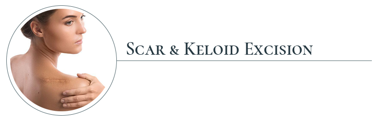 services_scar_keloid
