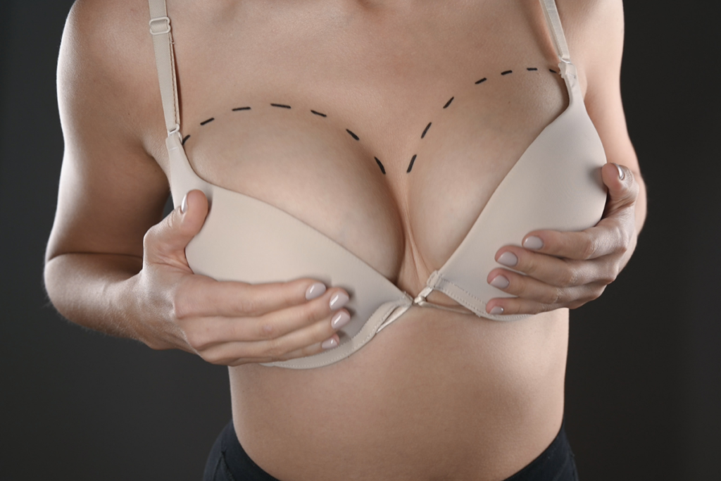 Breast Augmentation Recovery